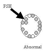 Abnormal FSH test