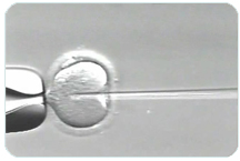 ICSI (intracytoplasmic sperm injection) with needle piercing a female egg | Tennessee Reproductive Medicine | Chattanooga, TN