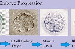 embryo progression | TRM IVF lab